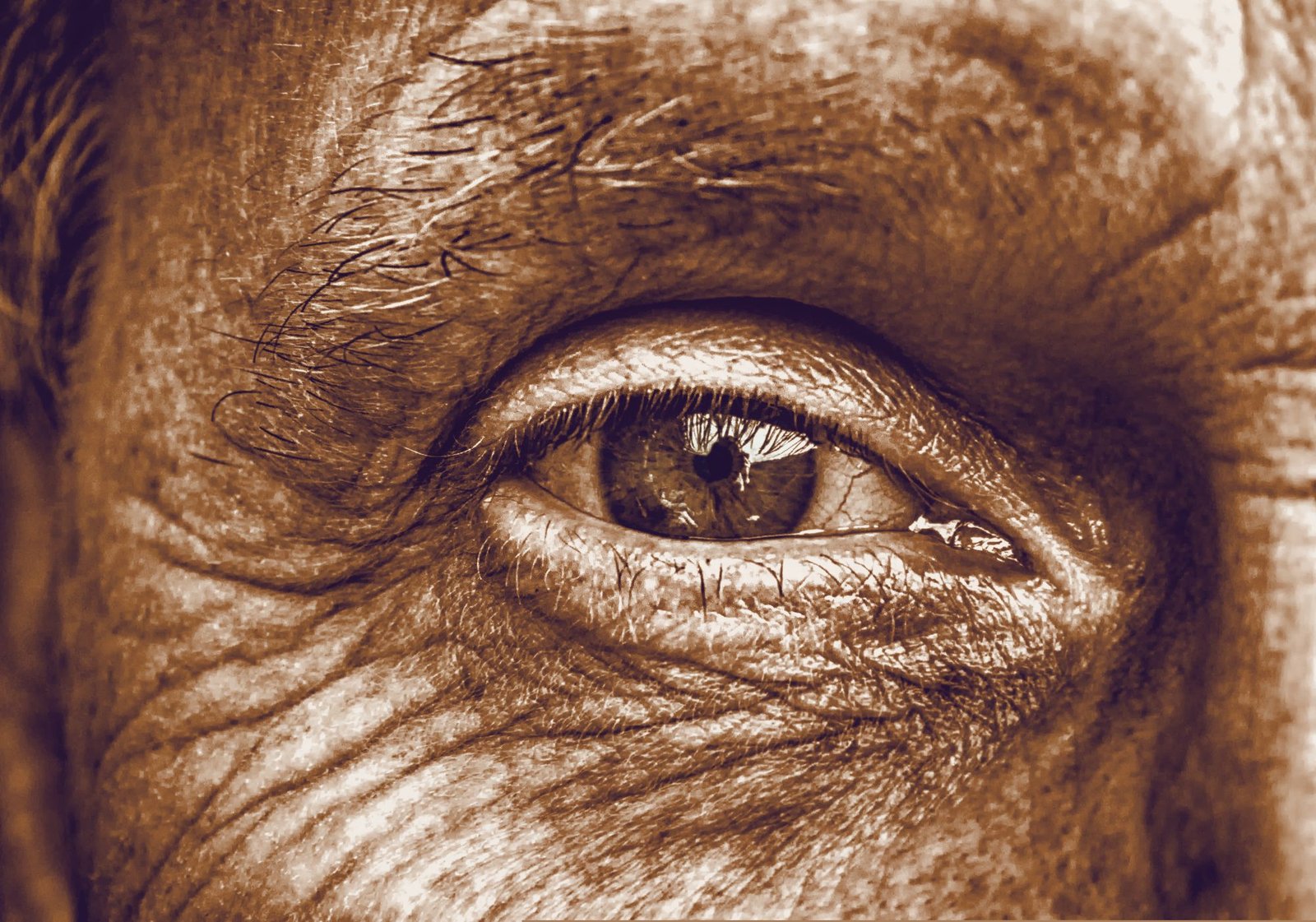 Close-up of an eye — dry eye assessment and treatment in Thane